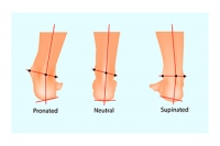 How Supination Can Affect Your Health